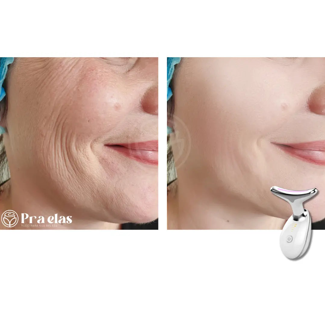 Massageador Rejuvenescedor Facial com LED ®