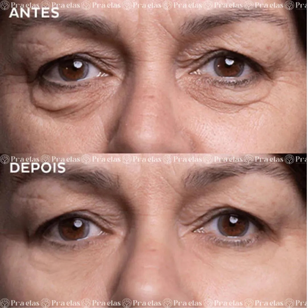 Creme Antirrugas Instantâneo - (8 Horas de Duração) ®